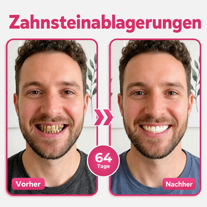 🎁🎁 Sichern Sie sich 50 % Rabatt beim Kauf eines zweiten Produkts!