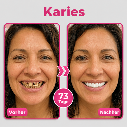 🎁🎁 Sichern Sie sich 50 % Rabatt beim Kauf eines zweiten Produkts!
