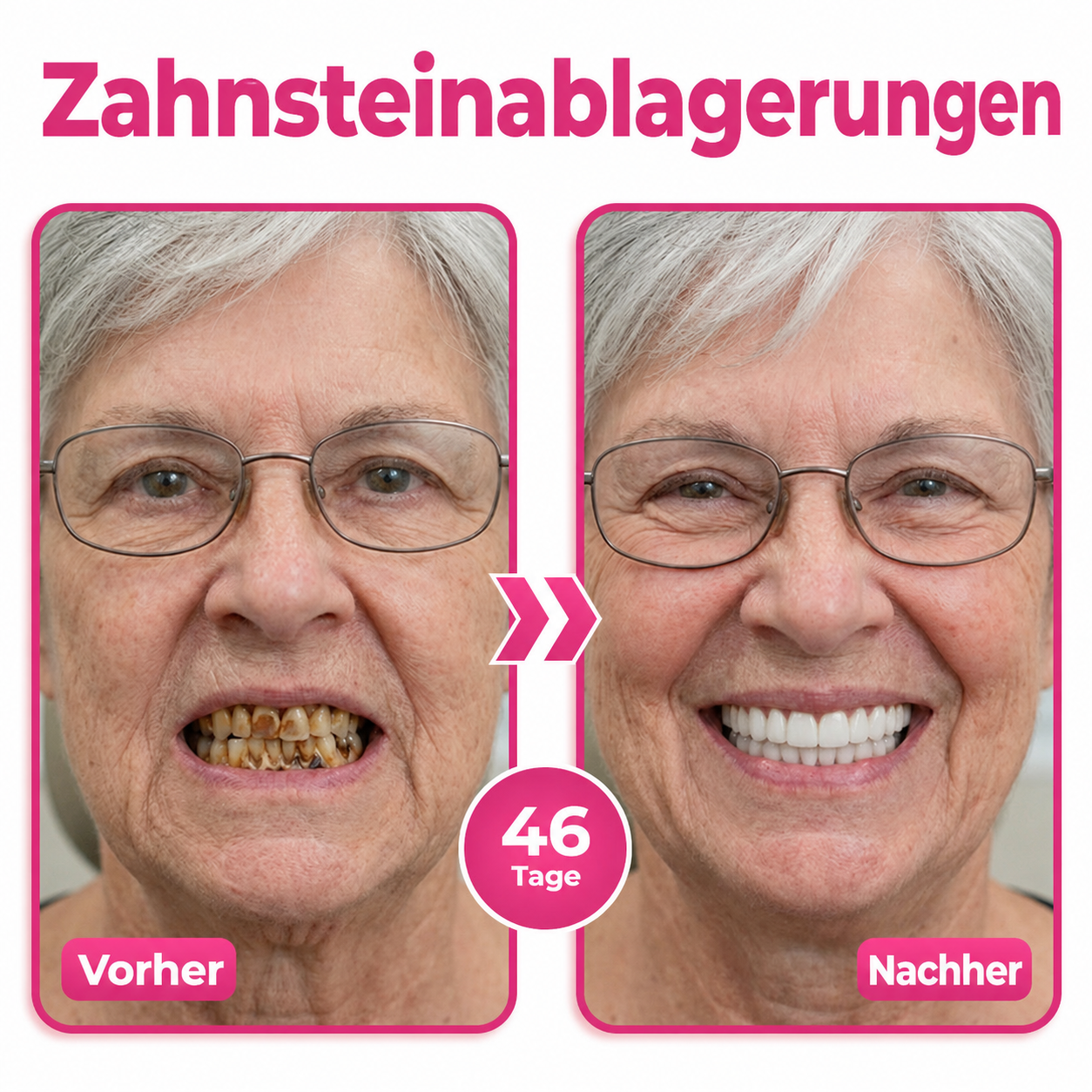 🎁🎁 Sichern Sie sich 50 % Rabatt beim Kauf eines zweiten Produkts!
